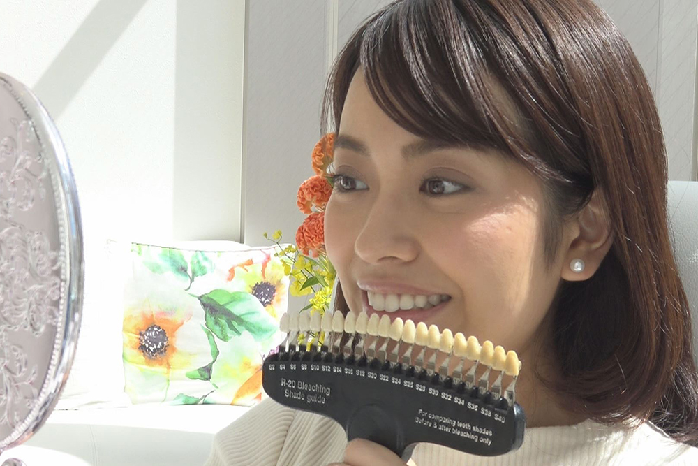 セルフホワイトニング